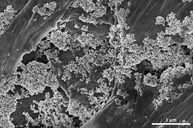 Logran eliminar microplásticos del agua con “nanoflores” de óxido de hierro