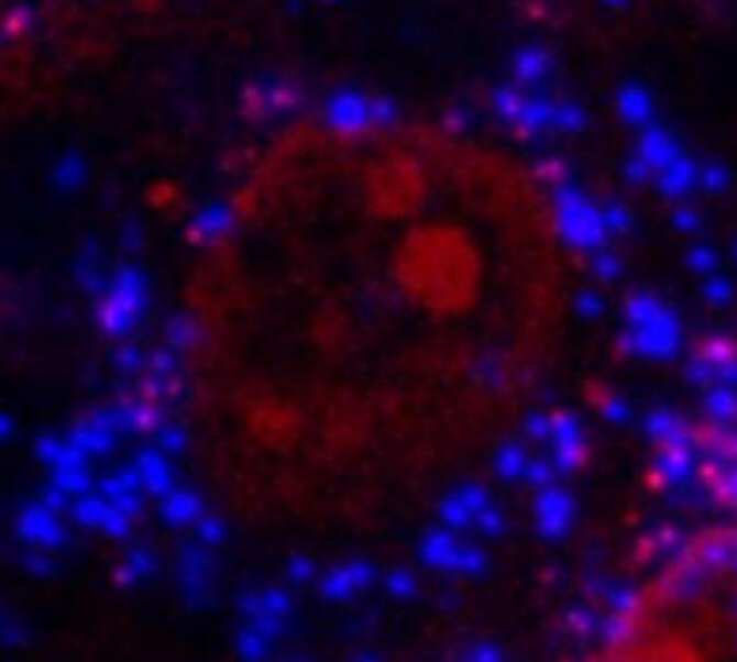 La amenaza de los microplásticos para la salud de los huesos