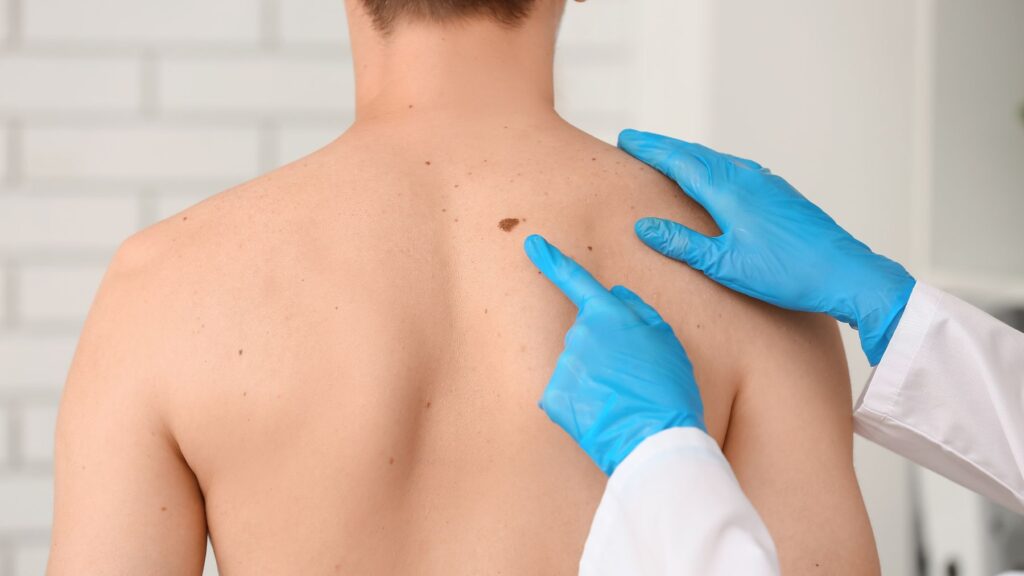 Nuevo estudio descubre que las cabinas de bronceado triplican el riesgo de melanoma y causan el doble de mutaciones genéticas en casi toda la piel, no solo en zonas expuestas